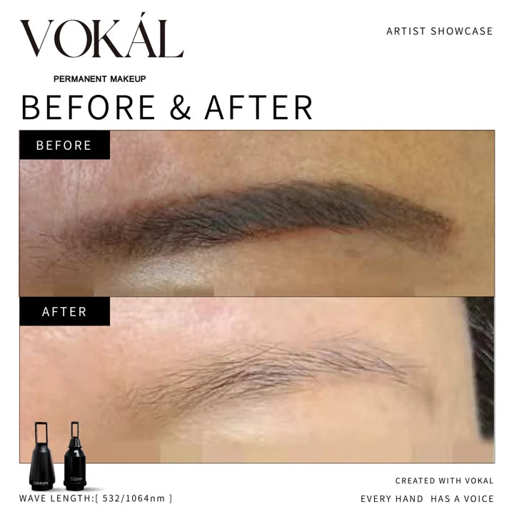 Brows before and after case 1