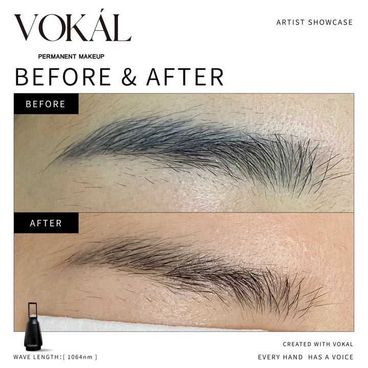Brows before and after case 2
