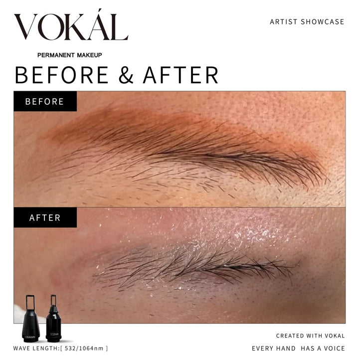 Brows before and after case 3