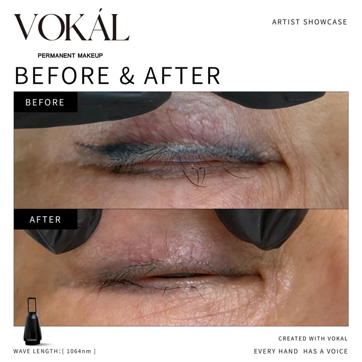 Lips before and after case 4