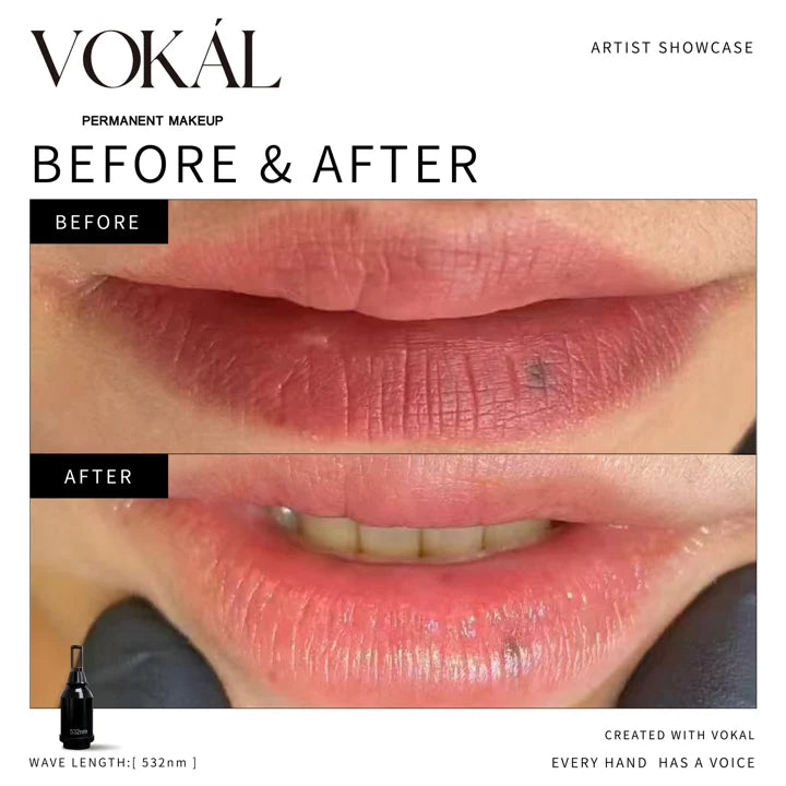 Lips before and after case 5