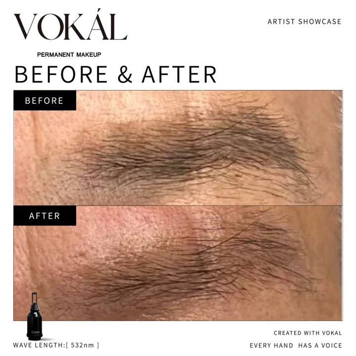 Brows before and after case 7