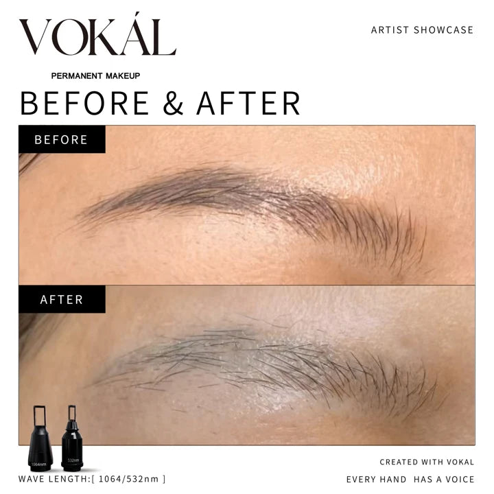 Brows before and after case 8