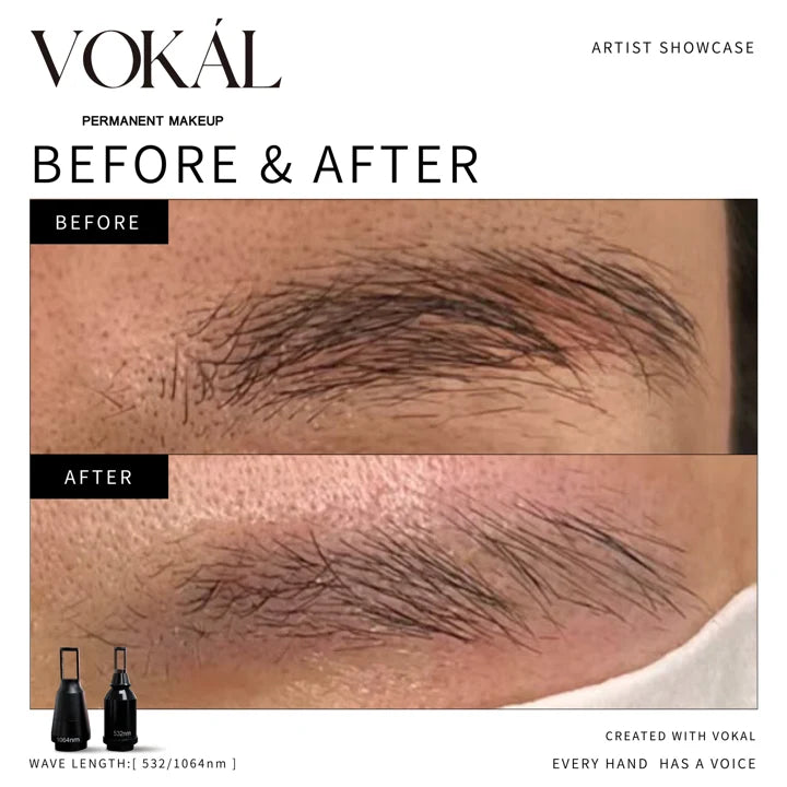 Brows before and after case 9