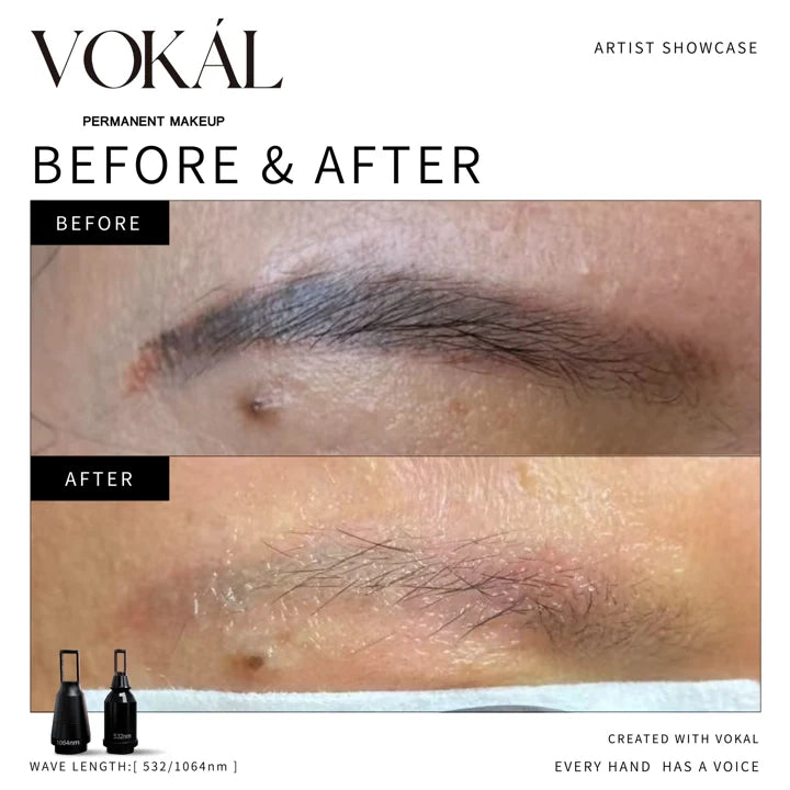 Brows before and after case 10