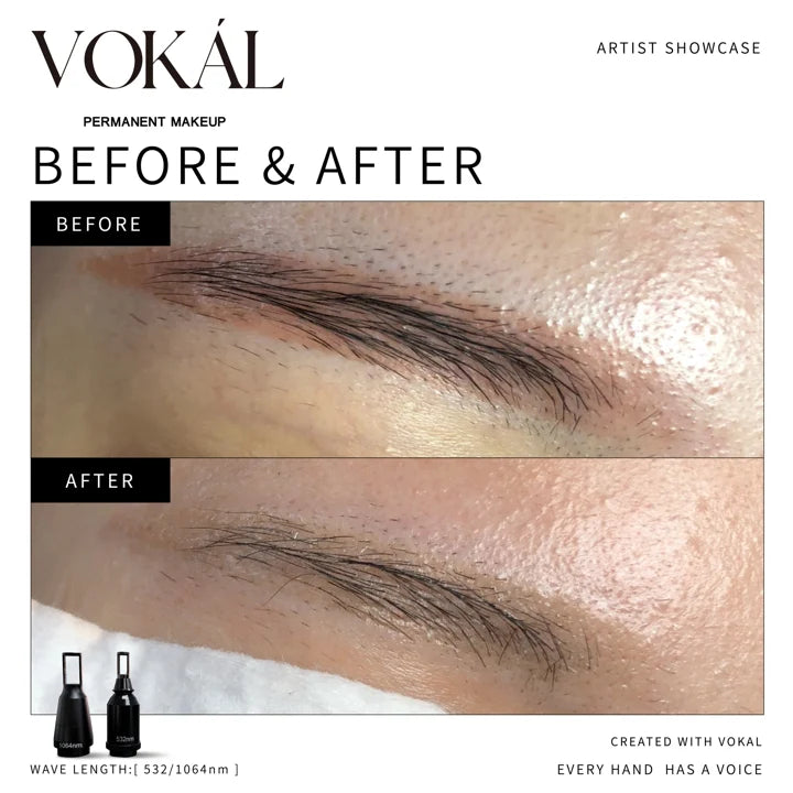 Brows before and after case 11