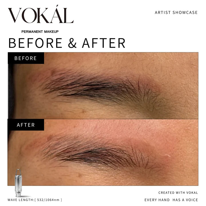 Brows before and after case 12