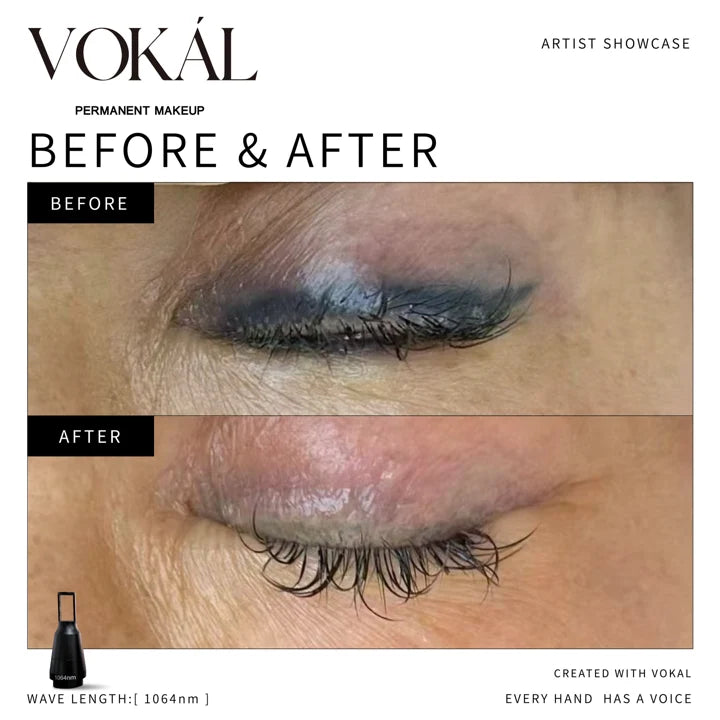 Eyeliner before and after case 13