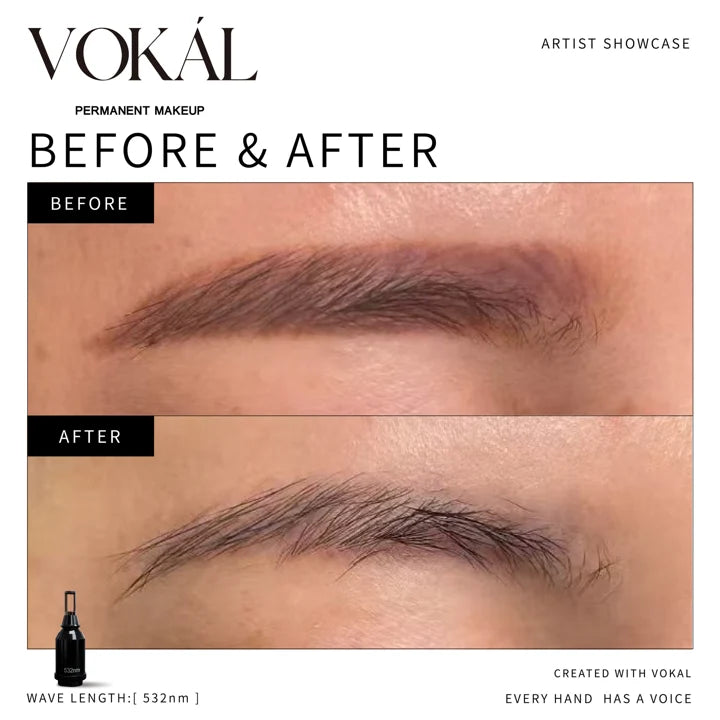 Brows before and after case 14