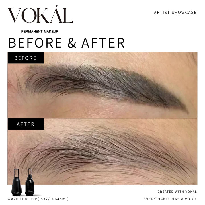 Brows before and after case 15
